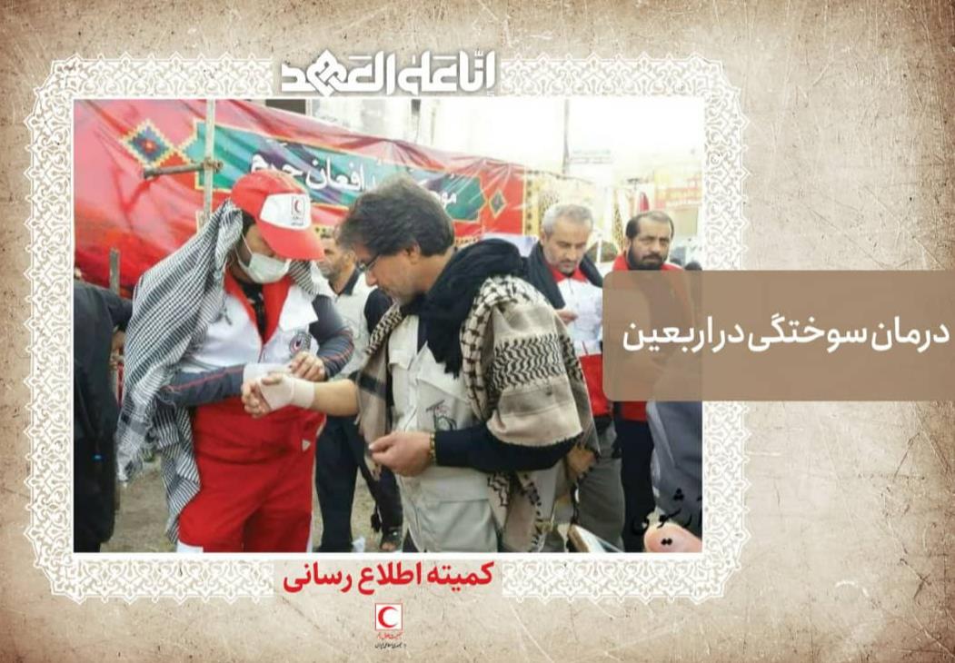 درمان سوختگی در پیاده روی اربعین